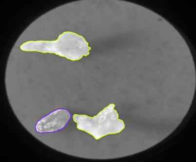 Microplastic particles segmented and outlined on a grayscale microscopy image